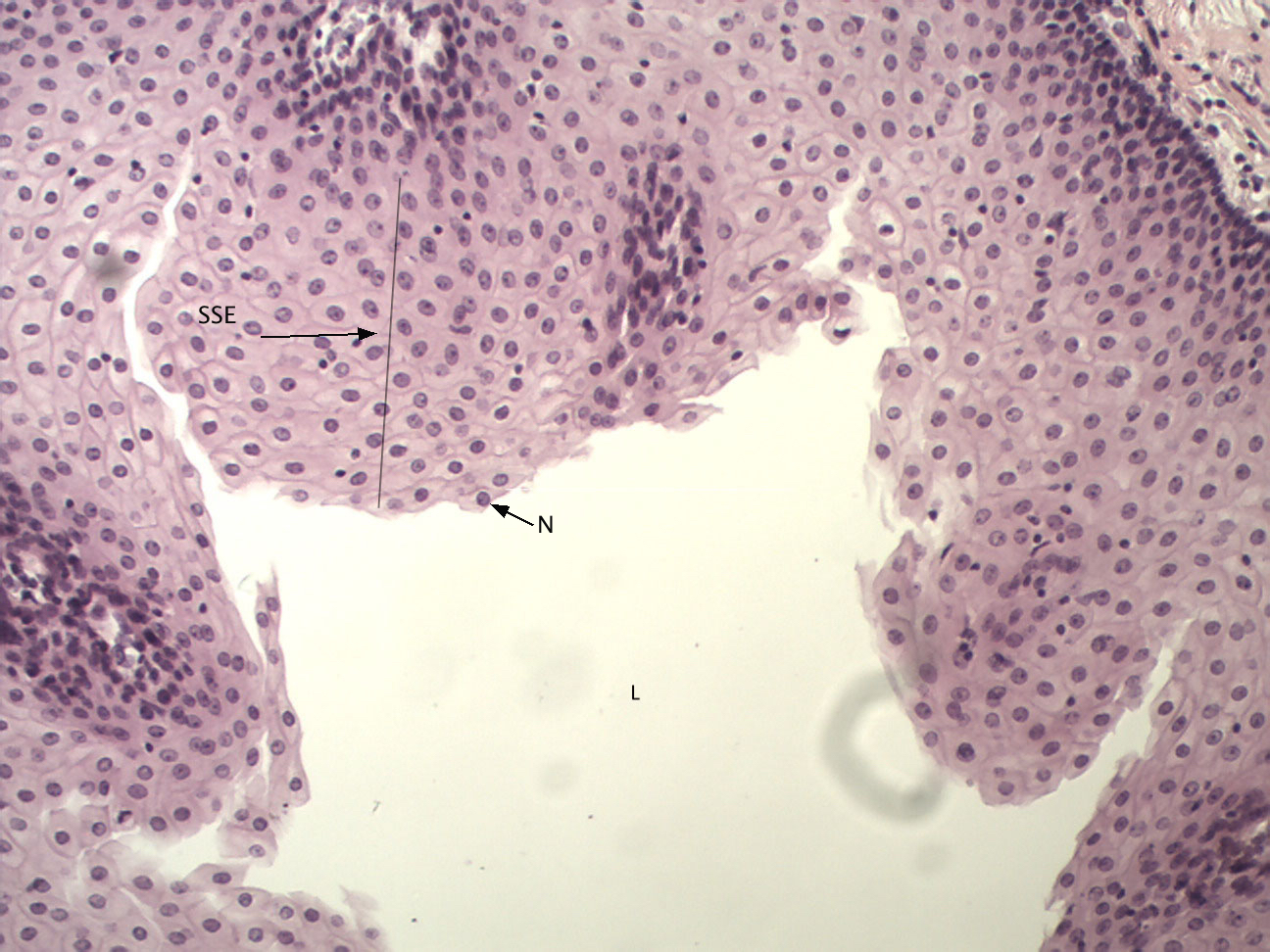 simple-columnar-epithelium-pseudostratified-columnar-epithelium-simple